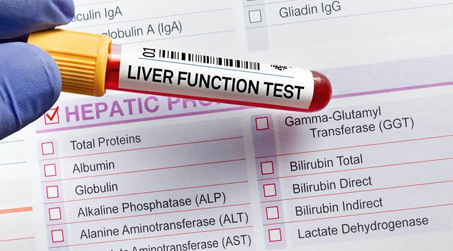 Liver Function Tests (LFT): Symptoms, Risks & When You Should Get Tested