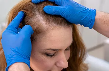 Hair-fall check-up For Women