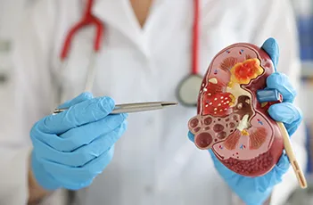 Kidney Function Tests - Basic